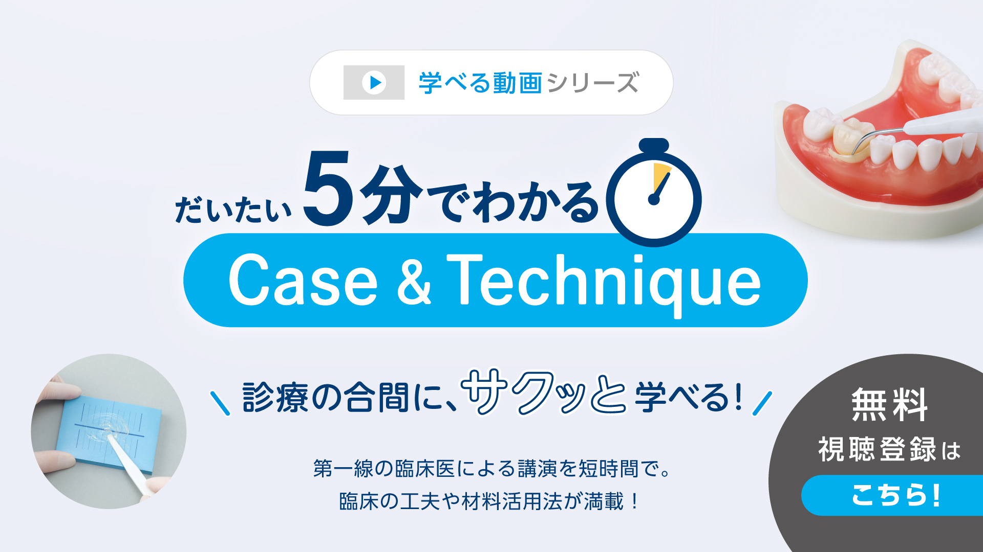 だいたい5分でわかる Case & Technique