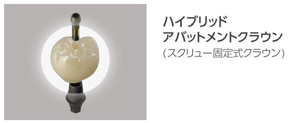 ハイブリッドアバットメントクラウン