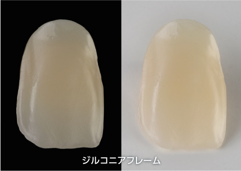 陶材併用法イメージ