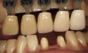 シェードテイキング
