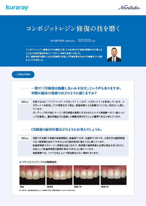 田代浩史先生 コンポジットレジン修復の技を磨く