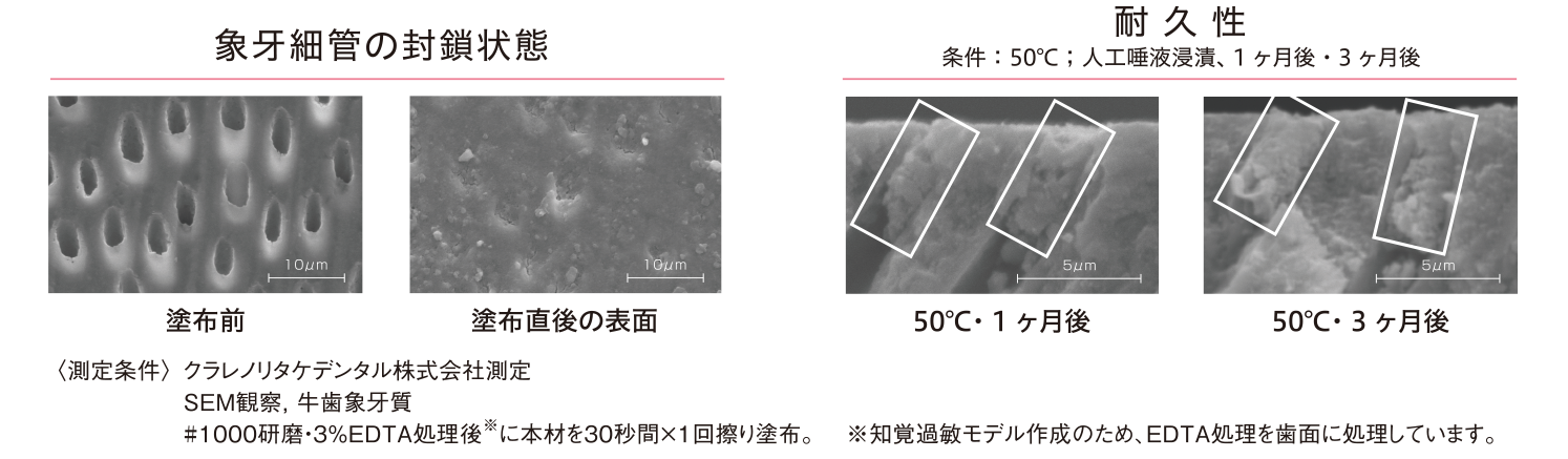 象牙細管の封鎖状態