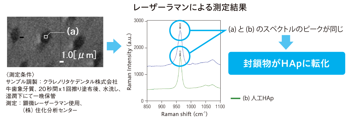 レーザーマンによる測定結果